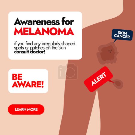 Melanoma Skin cancer. Skin cancer awareness post with Melanoma cancer spots on men back or front. Awareness social media post for Cancer Patients. Melanoma warning signs. Dermatologist Skin care