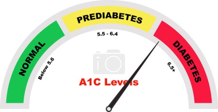 A1C High Test Meter, High Diagnosing Prediabetes, Hemoglobin Blood Test, Tube with blood, Medical Test blood sample, test result negative
