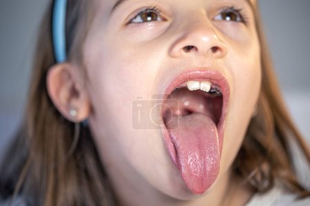 Ein kleines Mädchen öffnet den Mund und zeigt ihre Zehen, das Konzept der Zahnheilkunde, Kieferorthopädie.