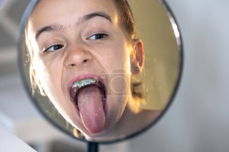 Chica preadolescente caucásica con frenos en los dientes chica con frenos en los dientes con la lengua colgando mirando al espejo, concepto de sonrisa perfecta.