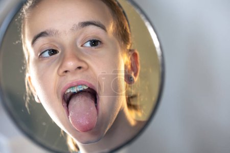 Kaukasisches Mädchen mit Zahnspange Mädchen mit Zahnspange auf den Zähnen mit heraushängender Zunge beim Blick in den Spiegel, perfektes Lächeln-Konzept.