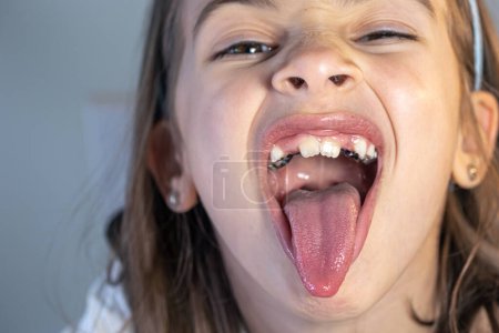 Kleines glückliches Mädchen in der Zahnarztpraxis, lächelnd mit überbissigen Zähnen, Kind beim Kieferorthopädiebesuch und Mundhöhlenuntersuchung, Kinderzahnpflege und -hygiene.