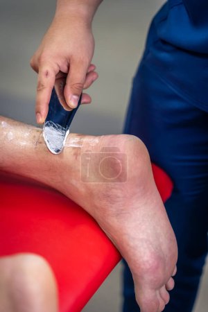 Photo for Heel and arch pain treatment with Instrument Assisted Soft Tissue Mobilization IASTM. - Royalty Free Image