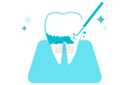 Zähne, die Plaque entfernen und schuppen