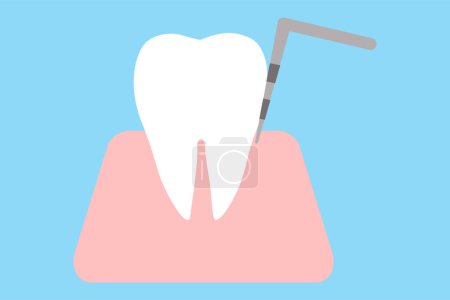 Examination of periodontal disease and periodontal pockets at the dentist