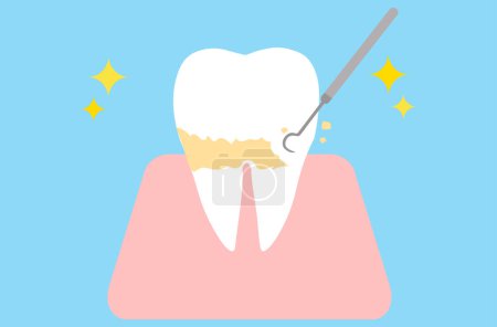 Zähne, die Plaque entfernen und schuppen