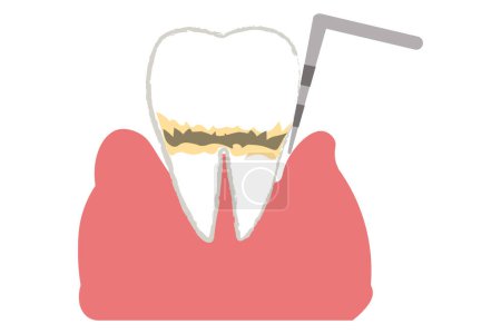 periodontales