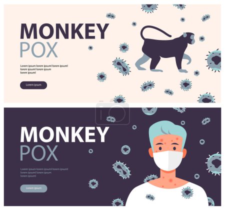 Monkeypox virus banner for awareness and alert against disease spread, symptoms or precautions. Monkey pox virus. Flat vector illustration