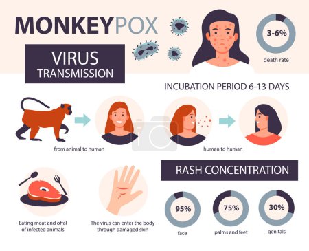 Infografía de la viruela del mono. Métodos de infección y áreas afectadas por la enfermedad. Ilustración vectorial plana.