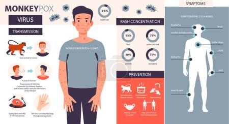 Infografía de los síntomas del virus de la viruela del mono. Causa infecciones en la piel. Dolor de cabeza, fiebre, erupción en el paciente. Ilustración vectorial plana.