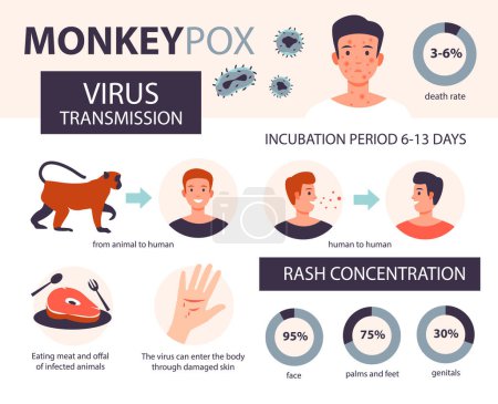 Monkey pox infographic. Infection, symptoms, prevention of the disease of monkey pox. Flat vector illustration.
