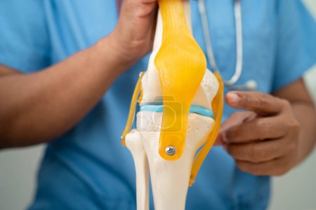 Asiatischer Arzt stellt orthopädisches Kniegelenkmodell für ältere Patienten vor.