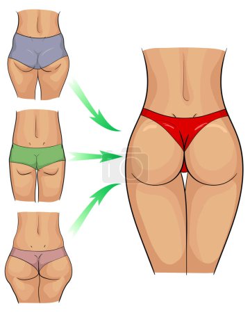 Ilustración vectorial de la transformación corporal durante la aptitud, la dieta o la cirugía. Ilustración de las partes problemáticas del cuerpo de las mujeres que se transforman en silueta de ajuste delgado perfecto. Transformar las nalgas de las mujeres.