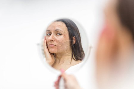 Photo of woman having skin problems looking in the mirror. Concept of skincare.