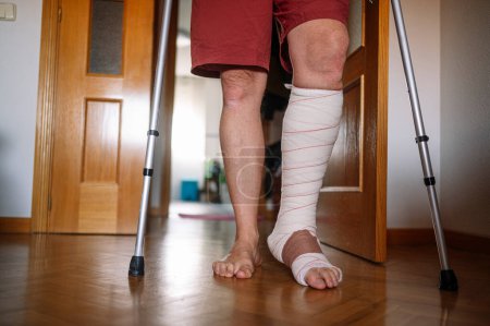 Photo for Injured man with bandaged foot walking at home with walking sticks. - Royalty Free Image