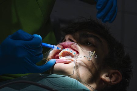 Téléchargez les photos : Adolescence à la clinique dentaire mettant support pour corriger les dents - en image libre de droit
