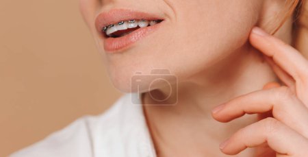 Photo for Close-up of a woman with braces on a beige background - Royalty Free Image