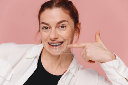 Foto de Mujer feliz moderna señalando con el dedo a los tirantes de metal sobre fondo rosa, concepto de ortodoncia - Imagen libre de derechos