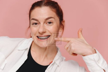 Foto de Mujer feliz moderna señalando con el dedo a los tirantes de metal sobre fondo rosa, concepto de ortodoncia - Imagen libre de derechos
