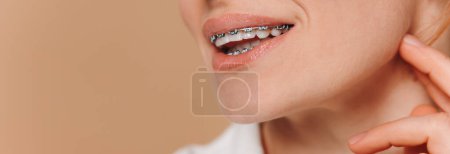 Close-up of a woman with braces on a beige background