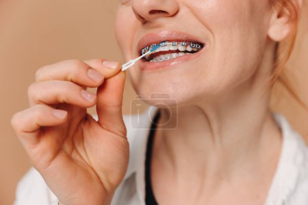 Photo for Close-up Unrecognizable woman cleans braces with a brush on beige background - Royalty Free Image