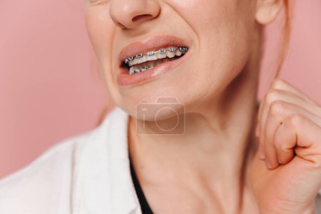 Photo for Close-up woman suffering from pain due to braces on pink background - Royalty Free Image