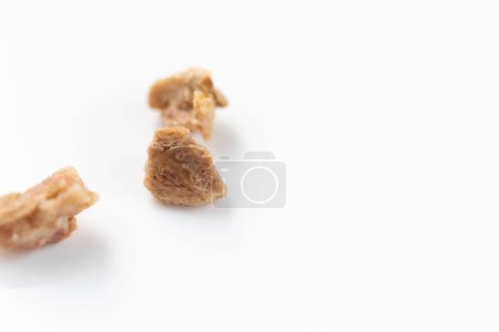 Foto de Cálculos renales. Se extirparon piedras de los riñones del paciente. - Imagen libre de derechos