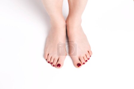 Hallux valgus on female legs on a white background. A bump on female legs close-up.