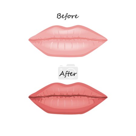 Lèvres de femme avant et après maquillage permanent. Couleur et fraîcheur plus vives. Illustration vectorielle isolée.
