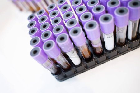 Photo for Laboratory vacuum blood sampling tubes on white background. - Royalty Free Image