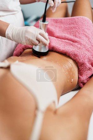 Foto de Cavitación RF tratamiento corporal y medicina contemporánea para la mejora de la belleza de la salud y la eliminación de grasa y celulitis - Imagen libre de derechos