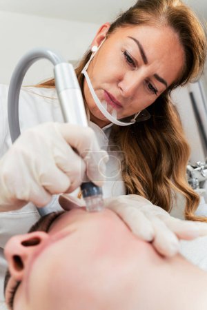 Photo for Young woman receiving hydra facial treatment for exfoliation, rejuvenation and hydration of her face skin. Modern facial hydro microdermabrasion peeling beauty procedure. Hydra vacuum cleaner. - Royalty Free Image