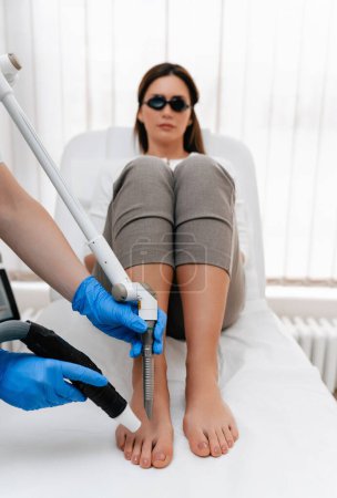 Beautiful middle age woman receiving foot laser resurfacing treatment. Modern and popular anti age procedure for removing old and stimulating new tissue creation.