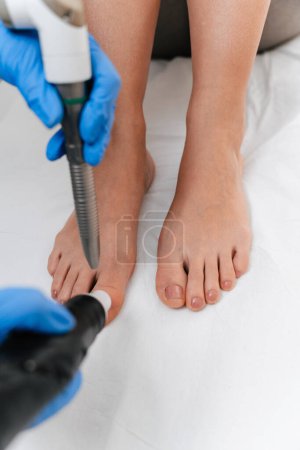 Photo for Beautiful middle age woman receiving foot laser resurfacing treatment. Modern and popular anti age procedure for removing old and stimulating new tissue creation. - Royalty Free Image