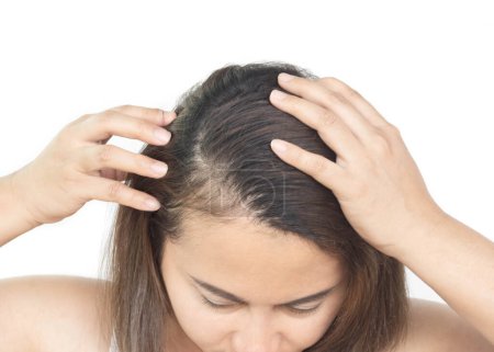 Close up Frau Hand hält Haarausfall Problem für Gesundheits-Shampoo und Beauty-Produktkonzept 