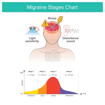Téléchargez les illustrations : Migraines stages chart, Migraines stages chart and a factors cause of Migraines symptom - en licence libre de droit