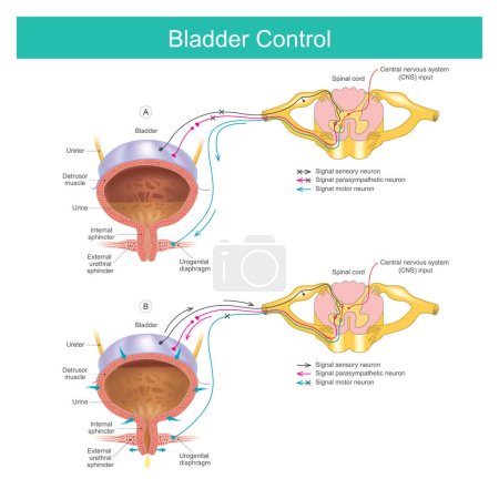 Illustration for Bladder Control. The bladder muscles control urination when the time is right - Royalty Free Image