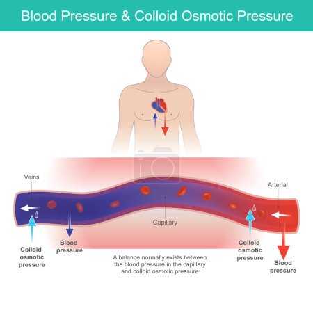 Illustration for Blood Pressure & Osmotic Pressure. The relationship of blood pressure and colloid osmotic pressure in human blood vessel. - Royalty Free Image