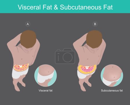 Illustration for Illustration knowledge of the abdomen visceral fat in human - Royalty Free Image