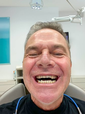 Téléchargez les photos : Charmant homme d'âge moyen montrant ses vieilles dents chez le dentiste avant d'obtenir de nouvelles dents chez le dentiste - en image libre de droit