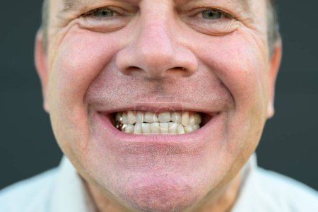 Foto de Primer plano extremo de la sonrisa de un hombre sin su prótesis frente a un fondo negro - Imagen libre de derechos