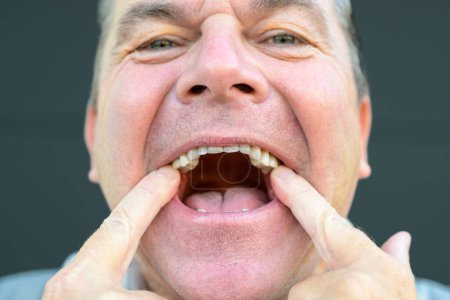 Foto de Extremo acercamiento de un hombre sin su prótesis dental delante y apuntando a la prótesis en el negro - Imagen libre de derechos