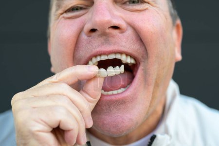 Foto de Primer plano extremo de un hombre sosteniendo su prótesis dental con los dedos sobre un fondo negro - Imagen libre de derechos