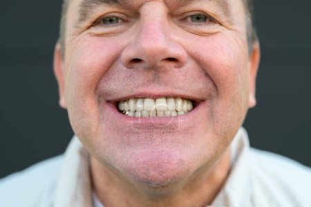 Foto de Extremo primer plano de la sonrisa de un hombre con grandes dientes delante de un fondo negro - Imagen libre de derechos