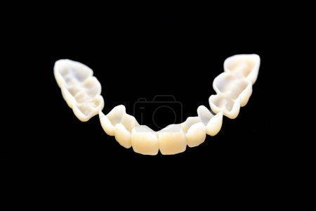 Foto de Primer plano de un modelo de diente impreso por impresión 3D sobre un fondo negro - Imagen libre de derechos