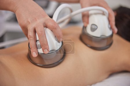 Photo for Lymphatic drainage, professional equipment, LPG massage. In clinic, vacuum body massage, problems areas slimming, suitable equipment for body care professional, lpg massage procedure, anti-cellulite - Royalty Free Image