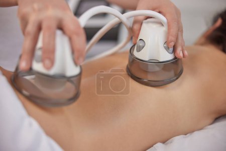 Photo for Beauty centre, Doctor cosmetologist, Applying vacuum. In medicine salon, range of therapeutic treatments such as vacuum body massage, problem area slimming, body care professional equipment, lpg - Royalty Free Image