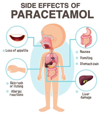 Téléchargez les illustrations : Human anatomy diagram cartoon style of paracetamol side effects illustration - en licence libre de droit