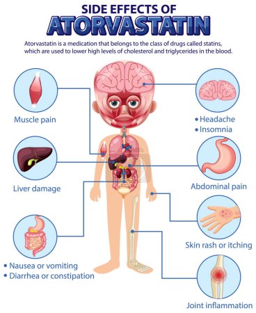Illustration for Human anatomy diagram cartoon style of Atorvastatin side effects illustration - Royalty Free Image