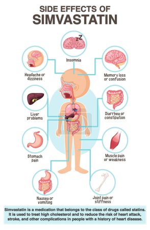 Ilustración de Human anatomy diagram cartoon style of simvastatin side effects illustration - Imagen libre de derechos